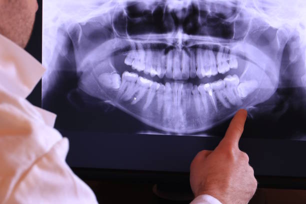 Best Emergency Treatment for Dental Infections or Abscesses in Rainier, WA