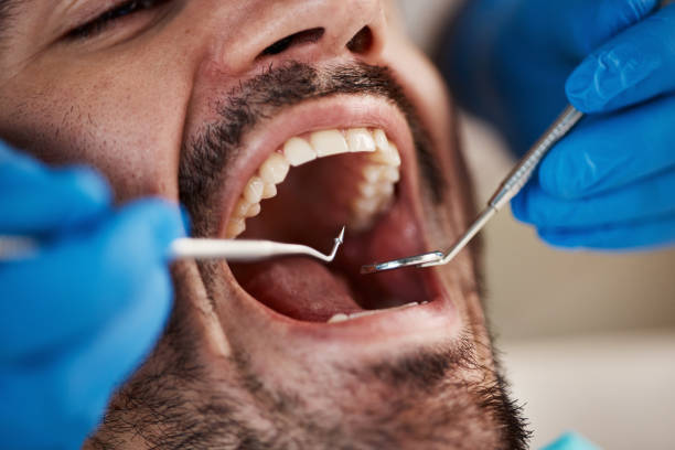 Best Emergency Treatment for Dental Infections or Abscesses in Rainier, WA