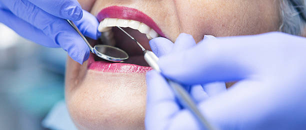 Best Emergency Tooth Extraction in Rainier, WA